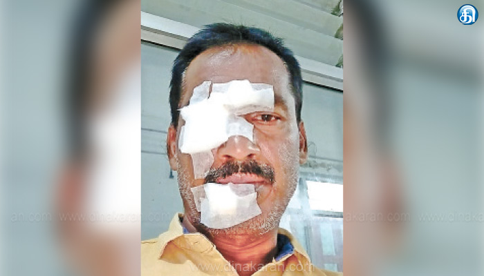 கொளுத்துது-வெயிலு…-வெடிக்குது-பீர்-பாட்டிலு…